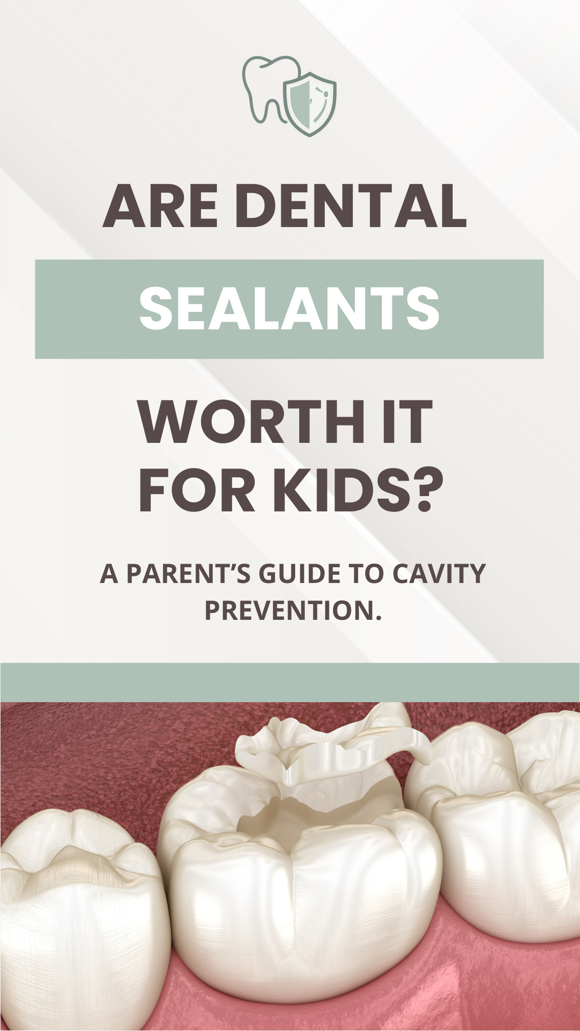 Are Dental Sealants Worth It for Kids cover