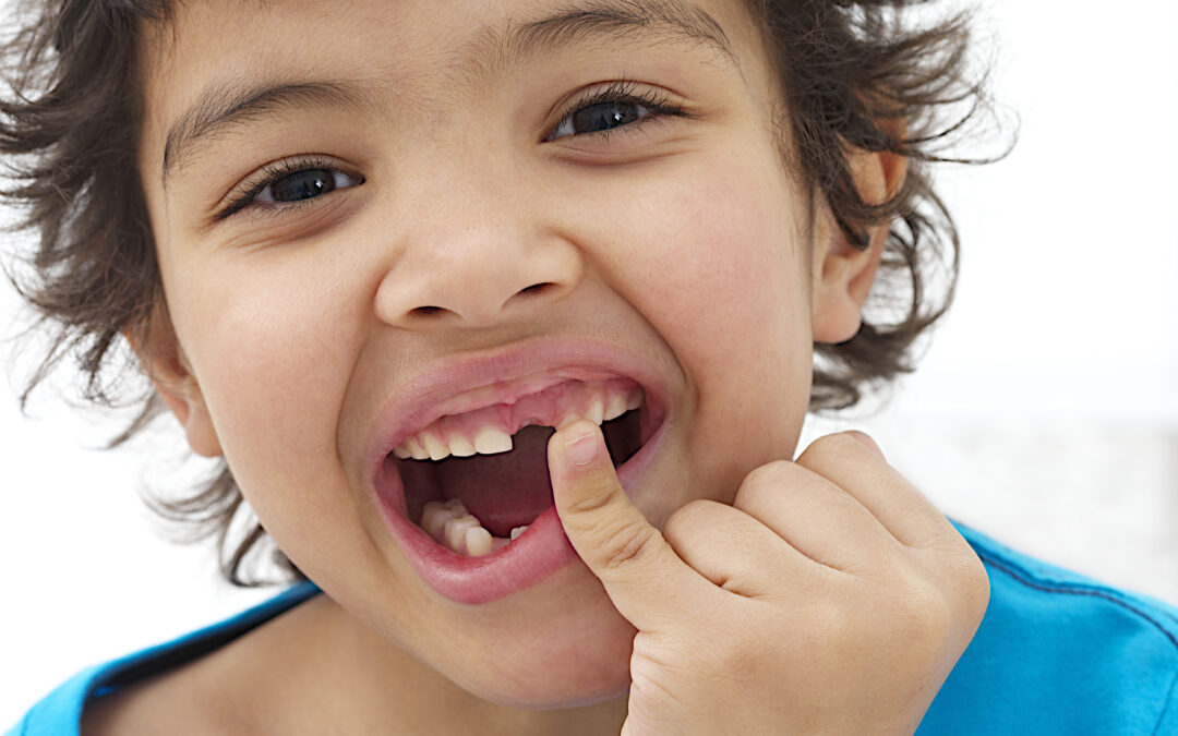 When Will My Child Lose Their Baby Teeth? A Pediatric Dentist Explains the Timeline