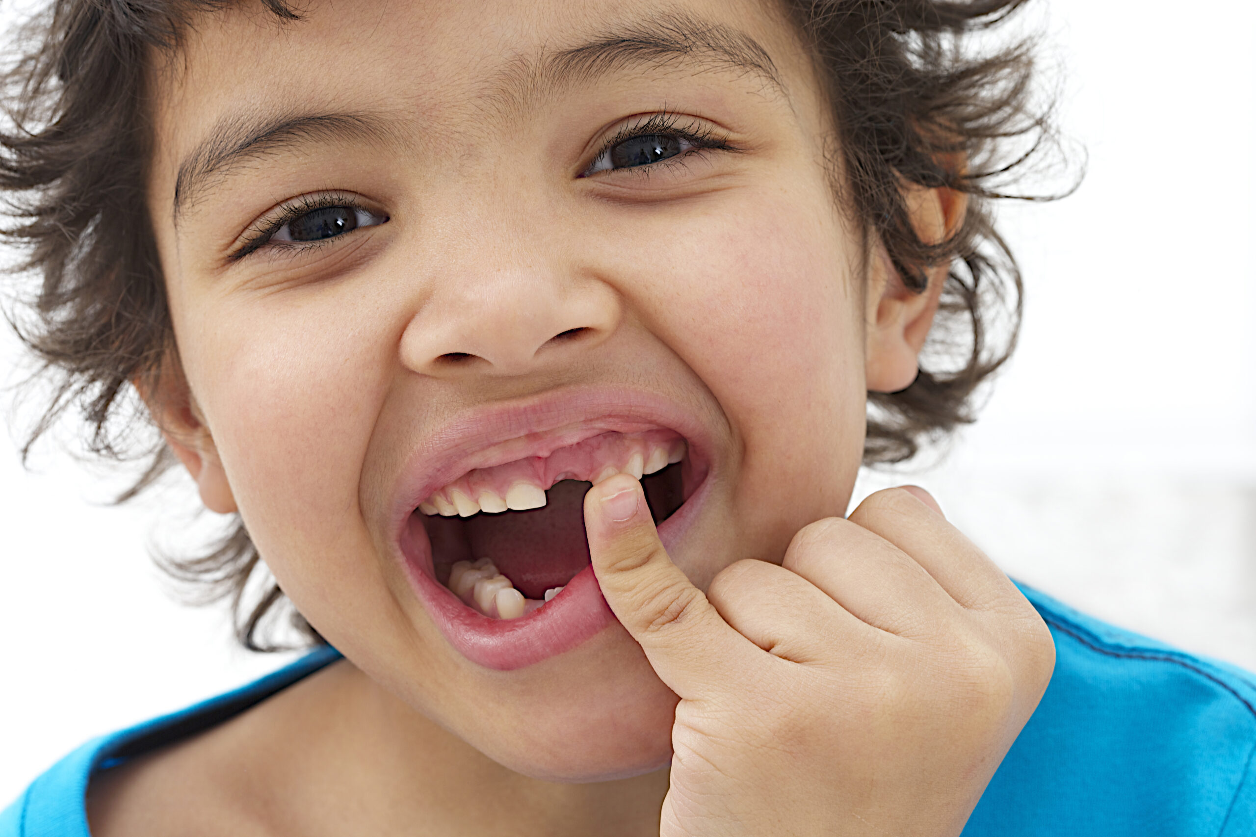 When Will My Child Lose Their Baby Teeth? A Pediatric Dentist Explains the Timeline