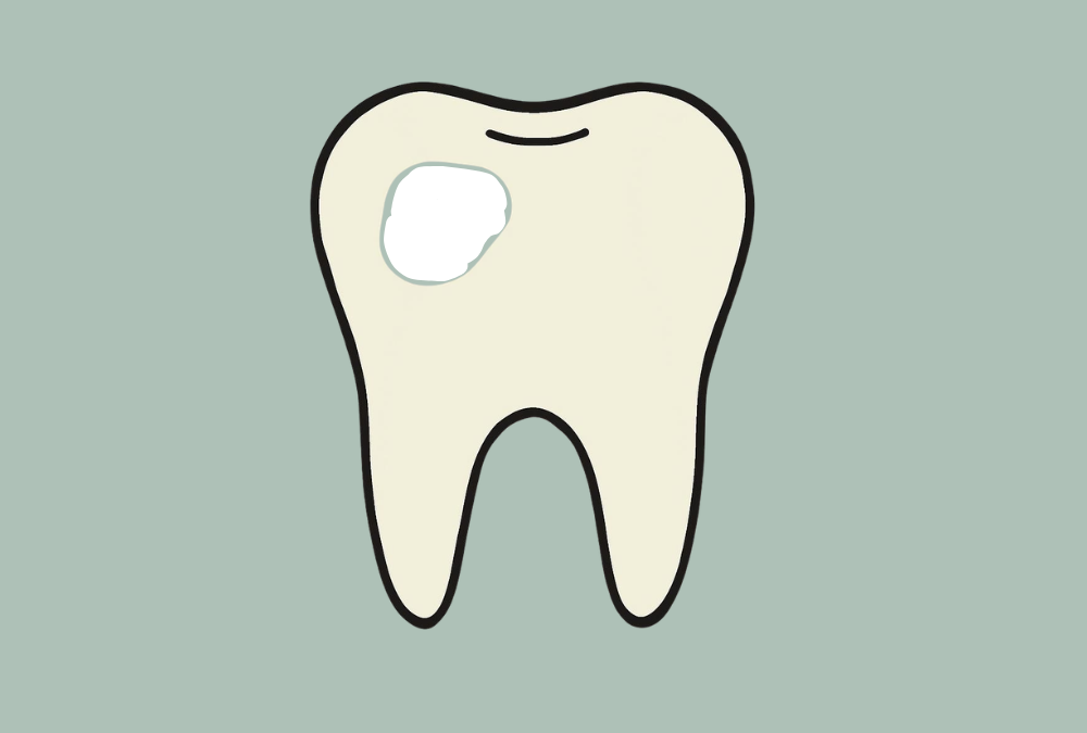 White Spot Lesions and Fluorosis